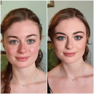 Prima e Dopo